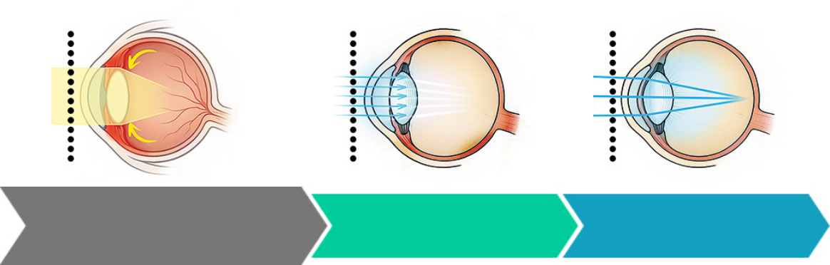 product-stages-image